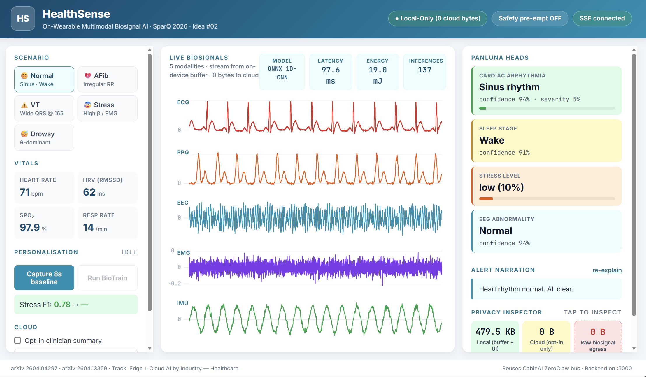 HealthSense - Multimodal Biosignal Foundation Model